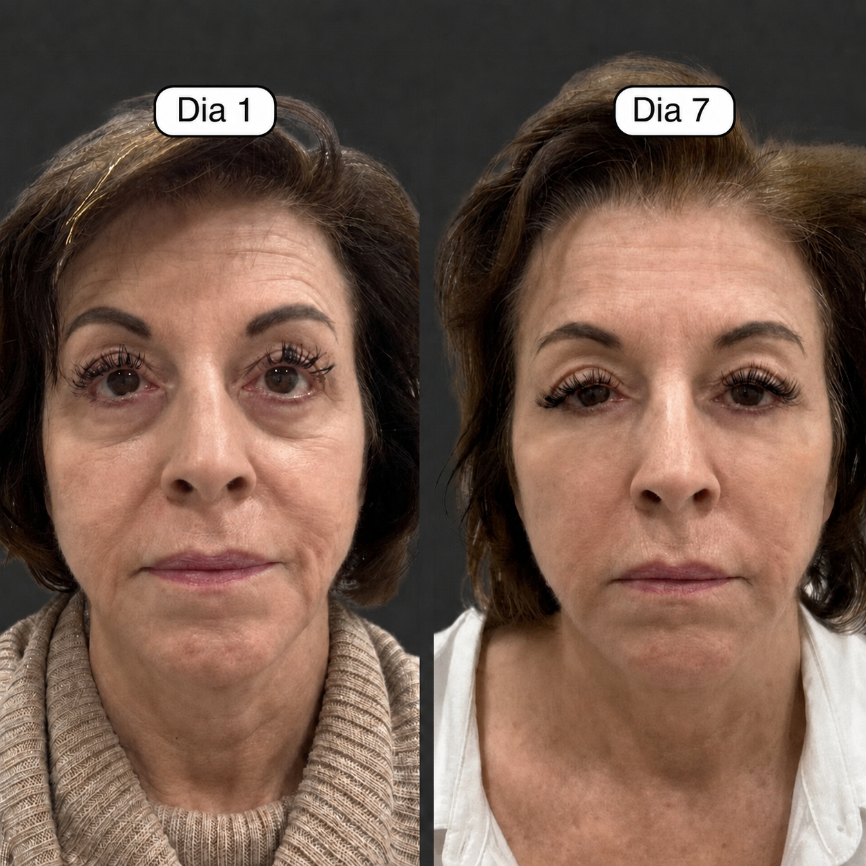 Escova facial ContourLift