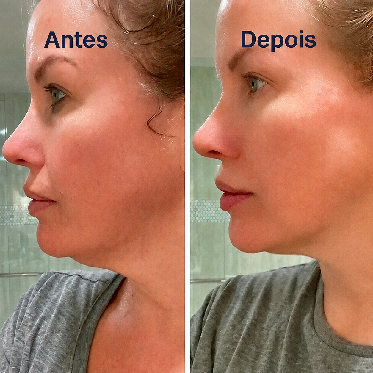 Escova facial ContourLift