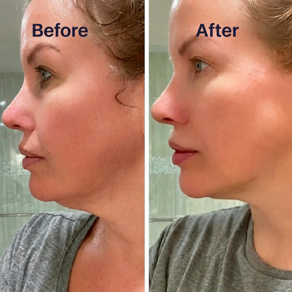 ContourLift Facial Brush